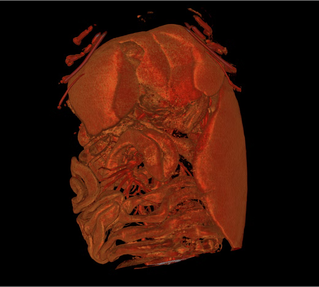 3d-bloodvessels
