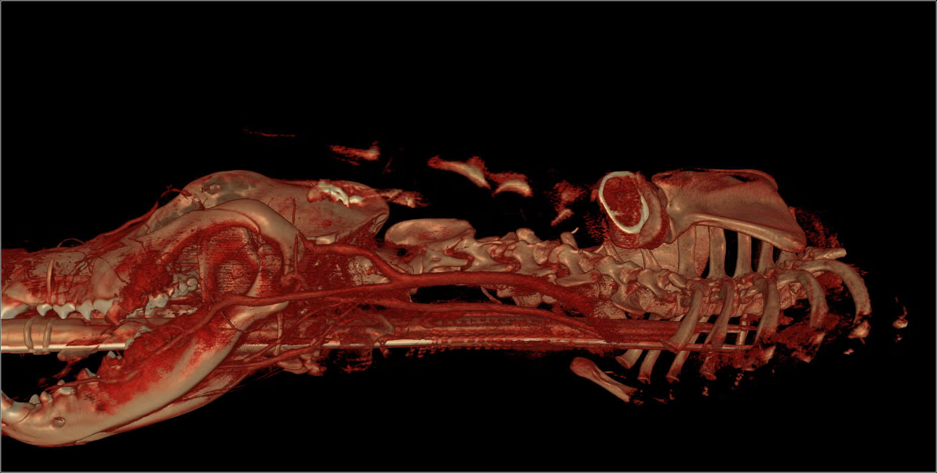 3d-spleen-kidney
