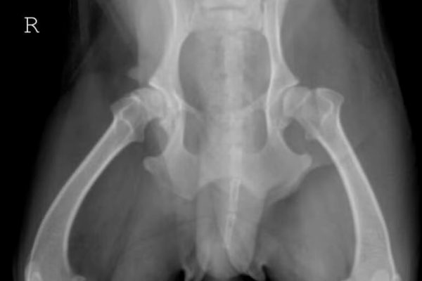 Dysplastic-Bilateral-OFA-Hips (1) Dysplastic-Bilateral-OFA-Hips (1)