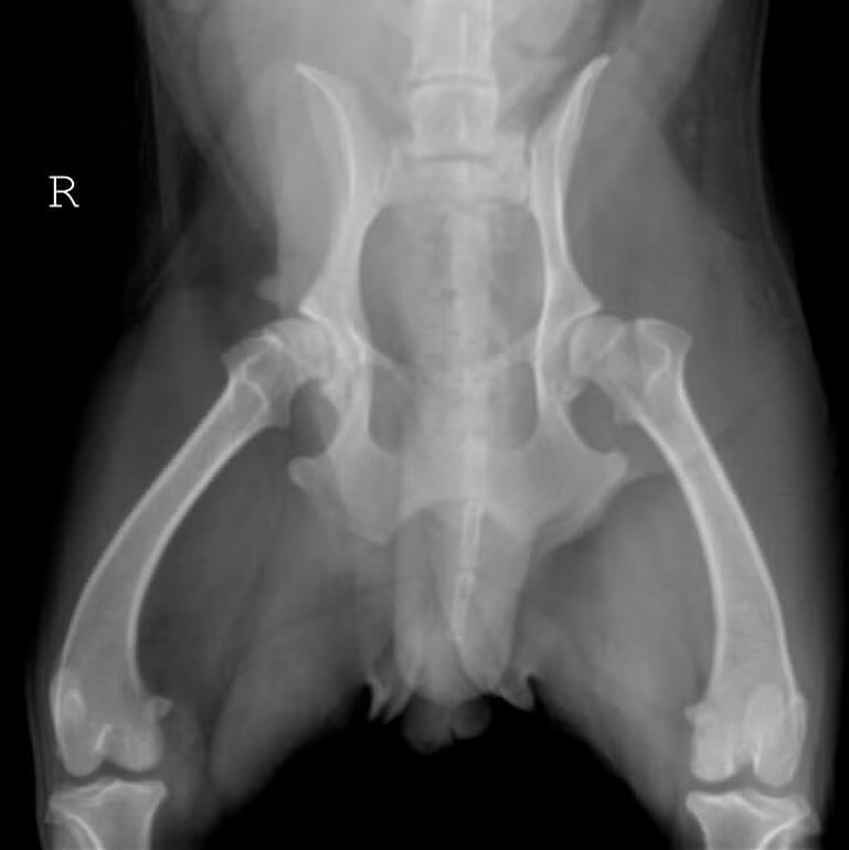 Dysplastic-Bilateral-OFA-Hips (1)