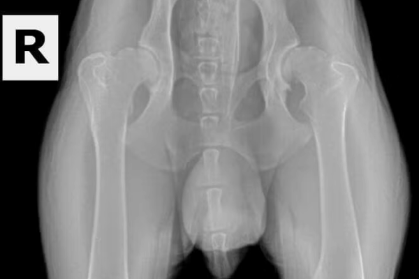 Dysplastic-OFA-Hips (1) Dysplastic-OFA-Hips (1)