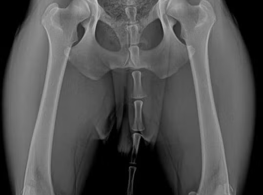 Fair-Hips (1) Fair-Hips (1)