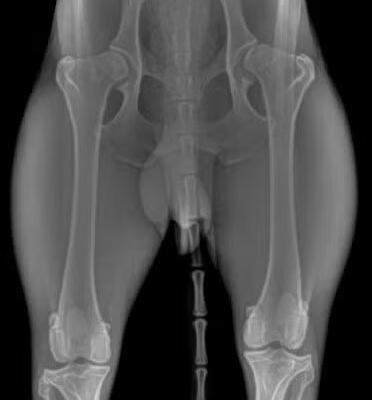Mild-Dysplastic-Hips (1) Mild-Dysplastic-Hips (1)