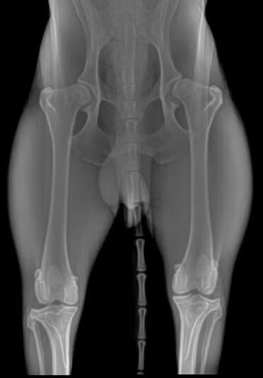 Mild-Dysplastic-Hips (1)
