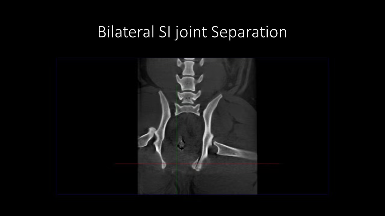 slide10