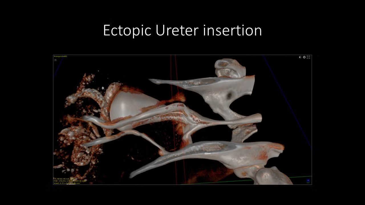 slide11