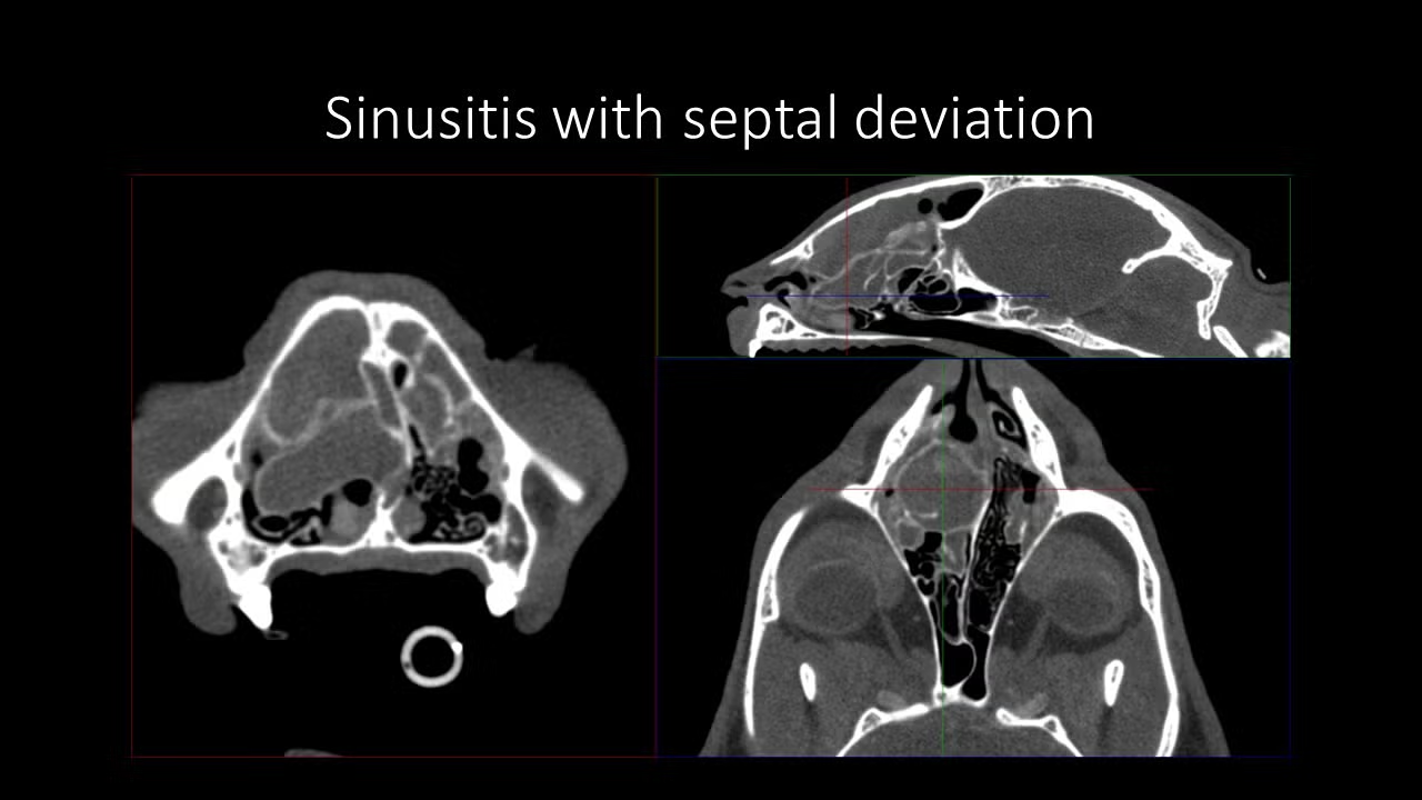 slide14