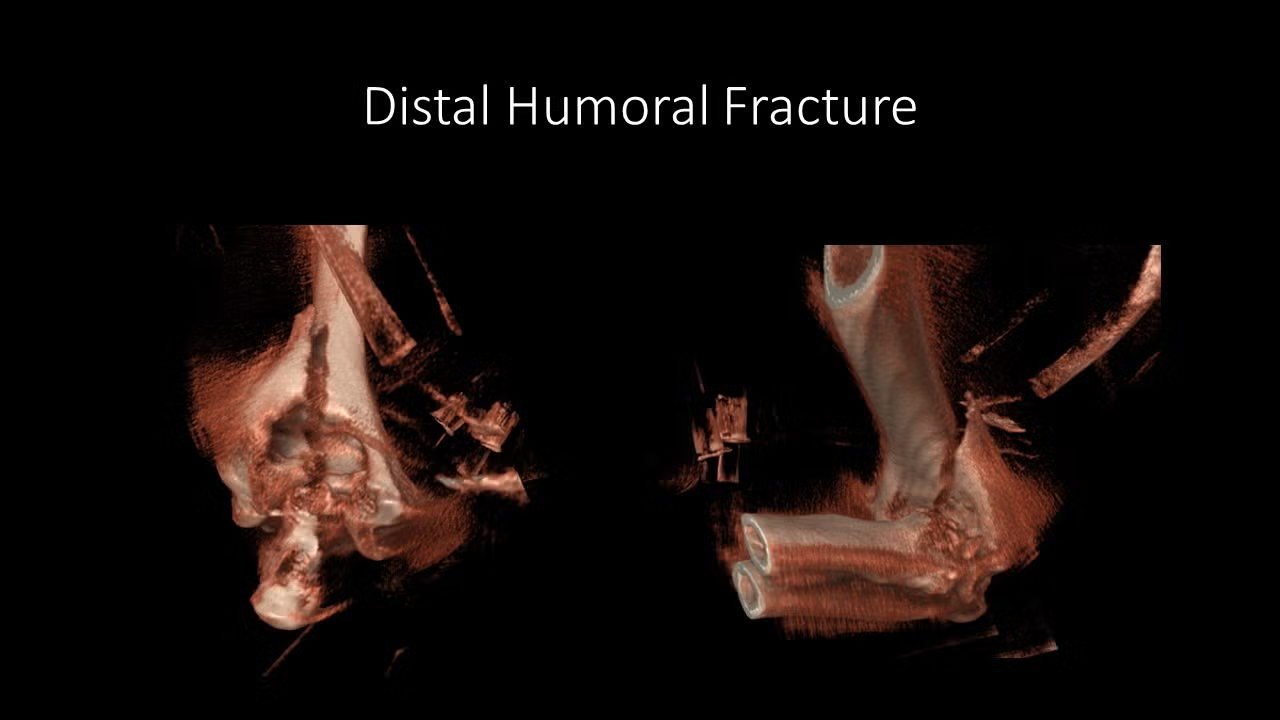 slide22